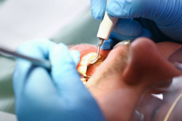 Best Emergency Dental Services for Seniors in Inverness, CA